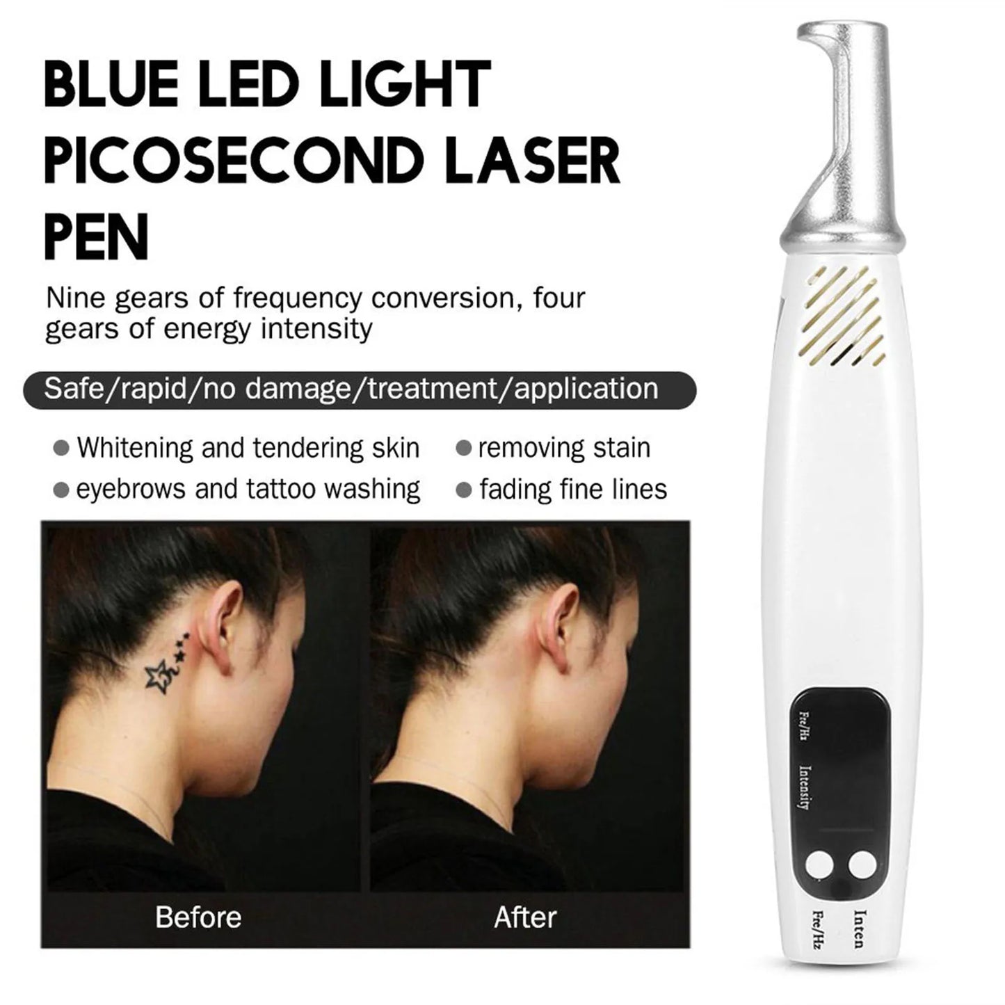 Handheld Picosecond Laser -Skin Beauty Device
